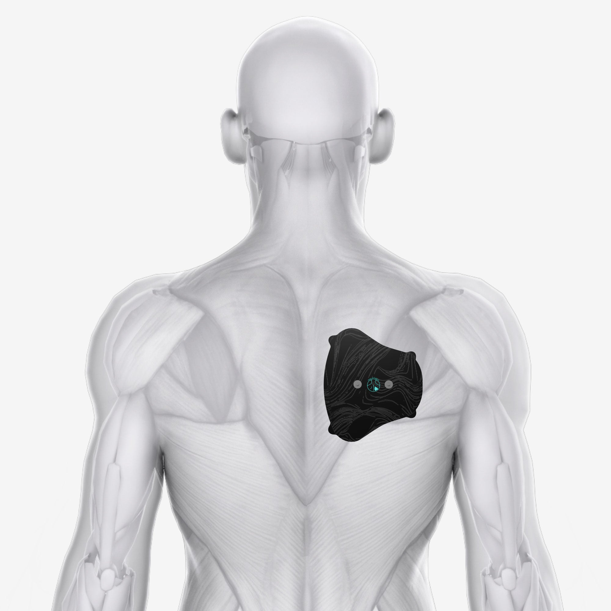 Chirp Halo Trap Pad Placement